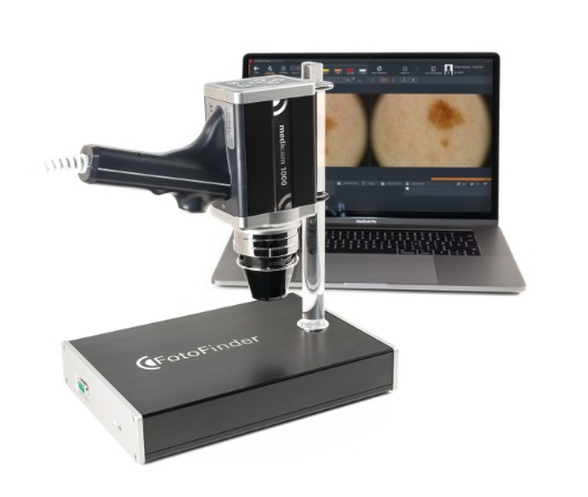 FotoFinder medicam1000